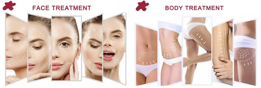 8D VaginalHIFU: features