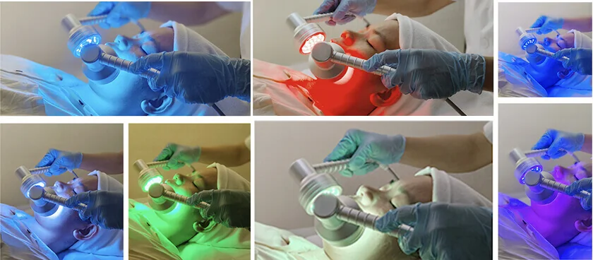 Hydradermabrasion: features