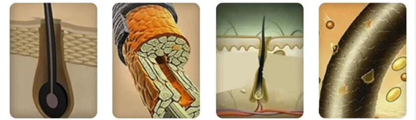 Crecimiento del Cabello con Láser: detalle del equipo