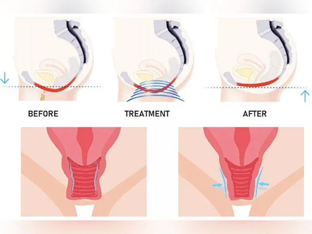 Sculptor Pelvic Floor Chair: equipment detail